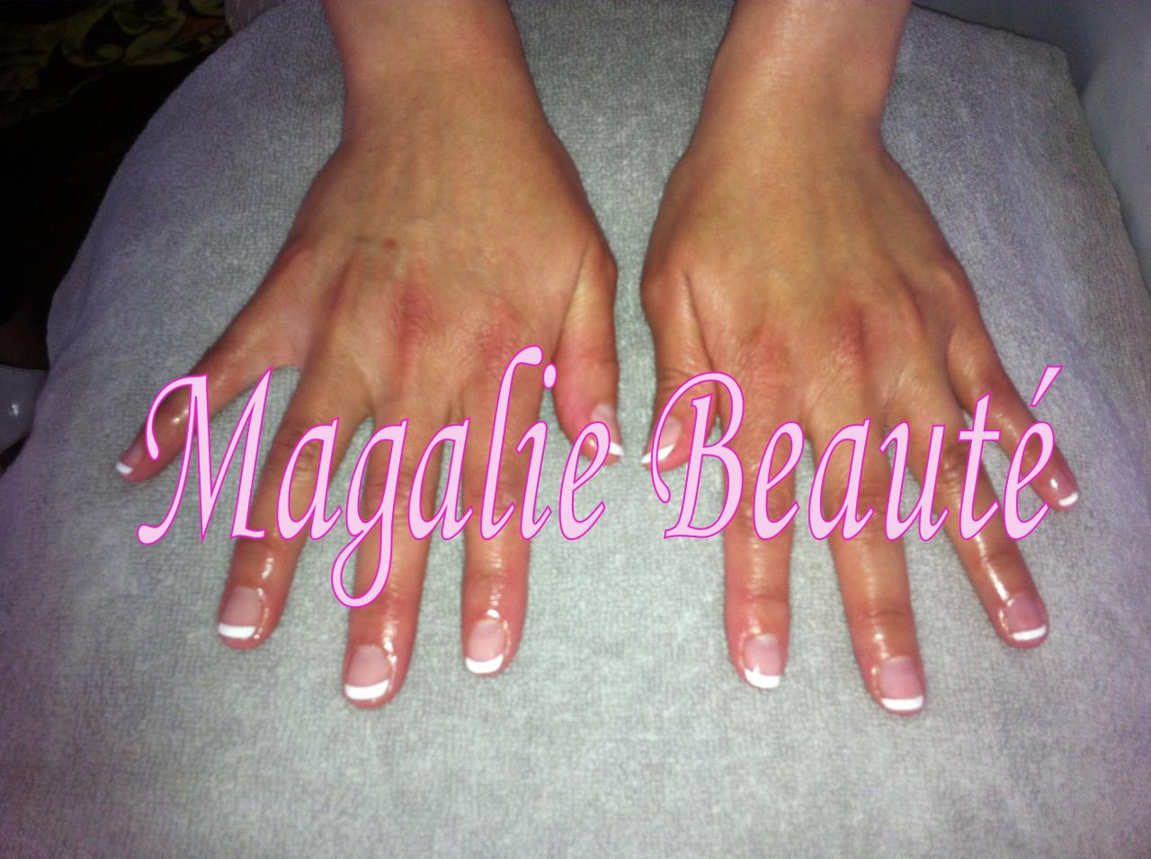 Vernis